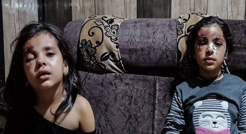 ماجرای حمله سگ‌های ولگرد به دو دختربچه در کرمان چه بود؟